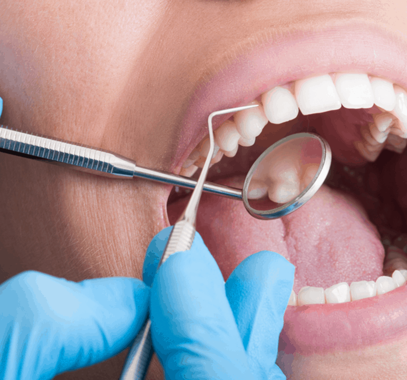 Best Implant Dentist In Ahmedabad